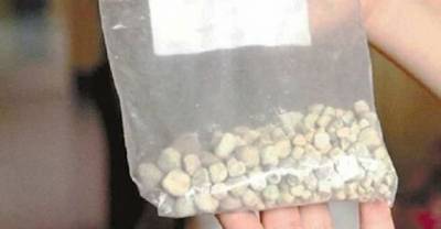 Tofu Loving Man Has 420 Kidney Stones Removed In Two Hour Surgery.