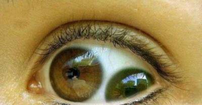 24 Seriously Creepy Real Human Eyes That Will Make Your Skin Crawl