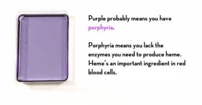 Every Color Your Pee Can Be And What It Means