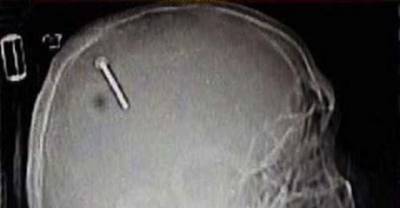 These 16 People Just Nailed It Hilariously!