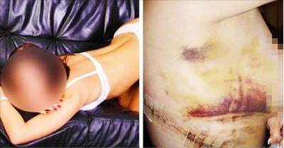 Mississippi Woman Cuts Off Her B00bs With Hunting Knife