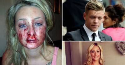 Girl Whose Lips Were Bit By Her Ex-Boyfriend Is Participating In Beauty Pageant