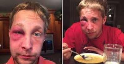 Teen With Asperger&rsquo;s Syndrome Teaches Bullies Who Beat Him Up A Life Lesson