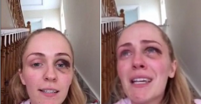 Mother-Of-Two Left With Black Eye After Being 'Punched By Her Ex-Lover'