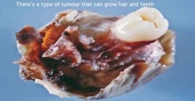 20 Incredible Facts About The Human Body You&rsquo;ll Wish You Could Unsee