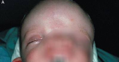 Strangest Babies Ever Born - Shocking Pictures (NSFW)