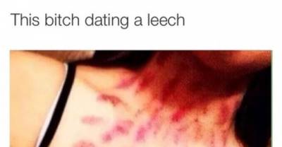 Some People Take Hickeys Too Far!