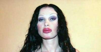 Please Step Away From The Cosmetic Enhancements