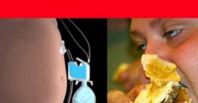 New Device Concept Sucks Food From Stomach So People Can Keep Eating