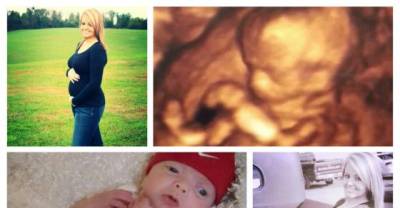 A Woman Woke Up From Coma To Find Out She Is A Mom