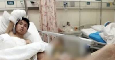 What These Doctors Did To Save A Man's Hand Is Straight Out Of A Horror Movie