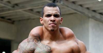 This Body-builder Almost Died After Getting Synthol Injections