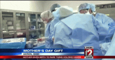 Giving Birth To Twins Is Very Rare, But I&rsquo;ve Never Seen This Happen Before