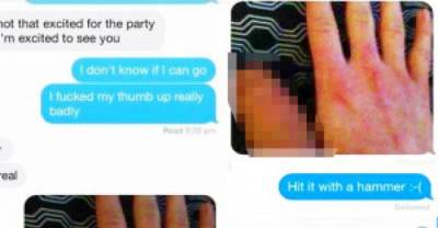 Guy Tricks Girl Into Thinking He Had A Really Swollen Thumb