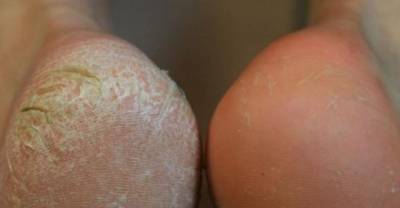 Foot Care Tricks To Treat Your Tired And Sore Feet