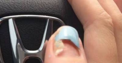 Warning: These Are 18 Of The Nastiest Images The Internet Has To Offer
