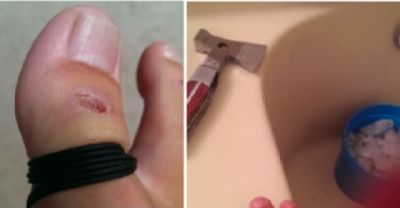 Meet The Guy Who Cut Off His Own Toe When Internet Asked Him To Do So