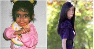 She Was Bullied And Called The World's Ugliest Woman But She Proved Everyone Wrong