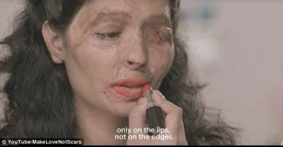 Courageous Acid Attack Victim Gives An Amazing Beauty Tutorial