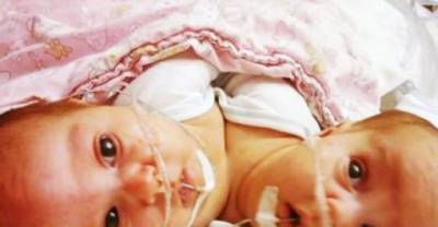 Check Out The 10 Most Curious Birth Stories! #7 Is Hard To Imagine.