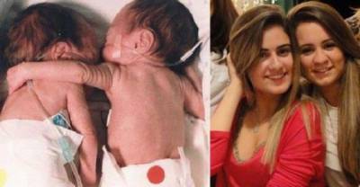 Her Twin Sister Was Almost Dead But What Happened Next Is Just A Miracle