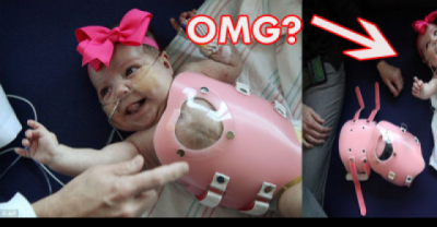 Miracle Baby Born With Her Heart Outside Her Chest
