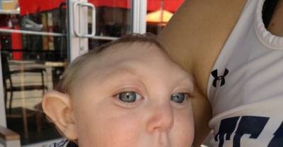 Miracle Baby With Fractured Skull Defies Doctor's Expectations And Lives