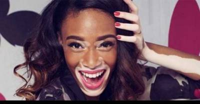 Winnie Harlow Is Definitely One-Of-A-Kind Model