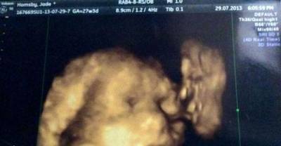 Mum Sees &lsquo;Dead Granddad Kissing Unborn Baby&rsquo; In 4D Scan