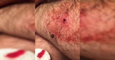 His Doctor Has No Idea What This Weird Thing On His Leg Is