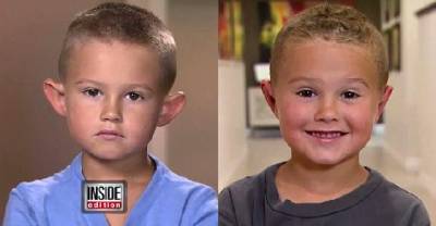 6-Year-Old Was Being Bullied So His Parents Gave Him Plastic Surgery!