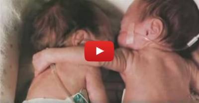 This Newborn Baby Girl Was Dying, Until Her Twin Did The Unthinkable