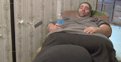 Guy Has 80lb Mass Removed From Scrotum After Doctors Said He Just Needed To Lose Weight.