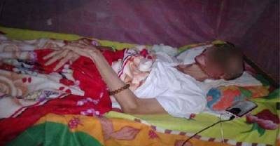This Man Came Down With A Flesh-Eating Virus, But Couldn't Afford Medication To Treat It