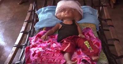 She Suffers From A Crippling Condition, And Her Family Doesn't Know What To Do