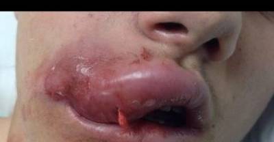 15 Horrifying Pictures Of The Kylie Jenner Challenge