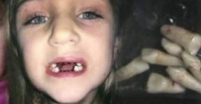 Evil Dentist Physically Abuses Children While He Mints Money