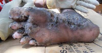 OMG! WTF If You Thought Mosquitoes Were Bad, Wait Until You See These Extremely Creepy Things..