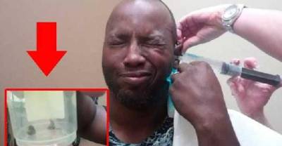 Man Went For Ear Checkup And What Came Out Was Unbelievable!