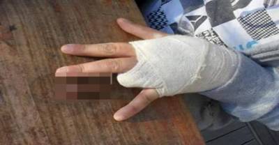 Man Cuts Off His Own Finger Over A Very Stupid Bet