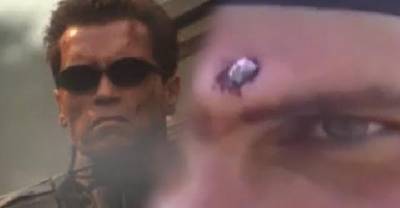 This Soldier Has A Bullet Embedded In His Head. How They Get It Out Is BRUTAL