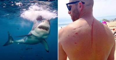 How A Shark Attack Ended Up Saving This Mans Life