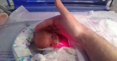 Its So Amazing To See A Miracle Baby Who Was Born So Tiny  Doctors Put Her In A Sandwich Bag