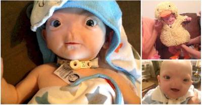 Baby Eli's Rare Condition Hasn't Stopped Him From Being The Cutest Baby On Facebook