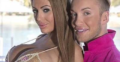 French Couple Spend Over $300,000 On Plastic Surgery To Look Like Barbie And Ken