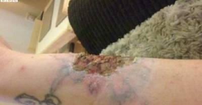 A Woman Made A Shocking Discovery After Attempting To Use A DIY Tattoo Removal Kit