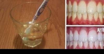 Natural Teeth Whitening With Just One Ingredient!