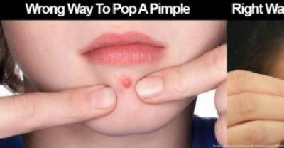 Pop A Pimple Properly Without Leaving A Scar