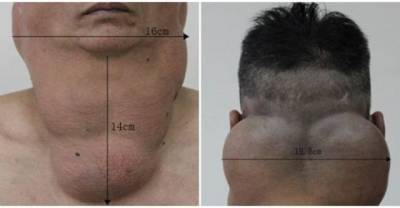 This Is What Happens When You Drink 2 Liters Of Alcohol A Day