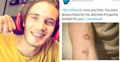 Dumb PewDiePie Fans Are Tricked Into Burning Themselves